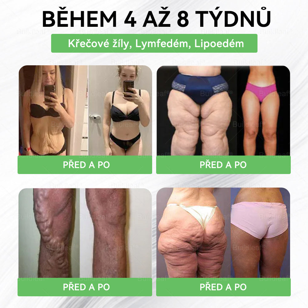 Zbývá posledních 5 kusů, sleva 50 %! 🌿 Omezené zásoby! Kupte si perorální roztok BuildLeaf® nyní a užijte si rychlé hubnutí za poloviční cenu! 💪