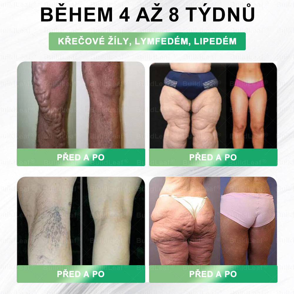 🍃Omezené zásoby! BuildLeaf®🎁Extra sleva 30%! Obnovte své tělo a zdraví.
